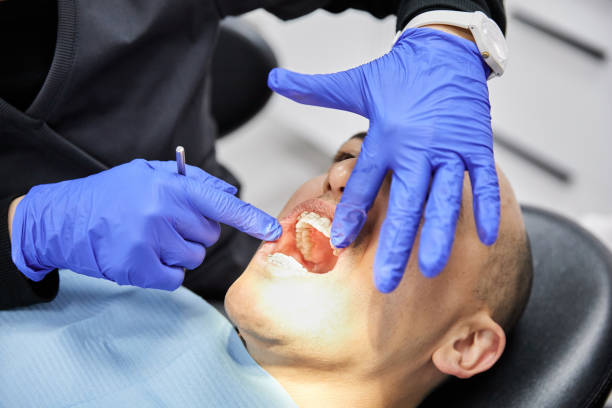 Best Emergency Tooth Extraction in Sparta, WI