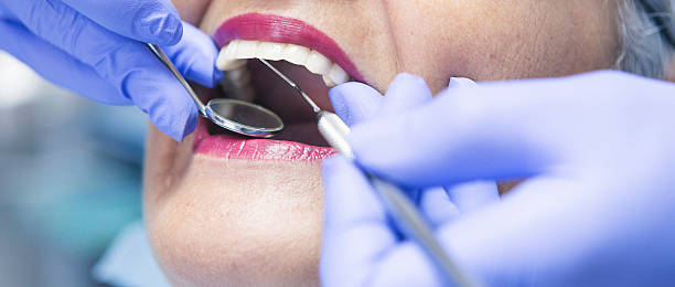 Best Emergency Treatment for Dental Infections or Abscesses in Sparta, WI